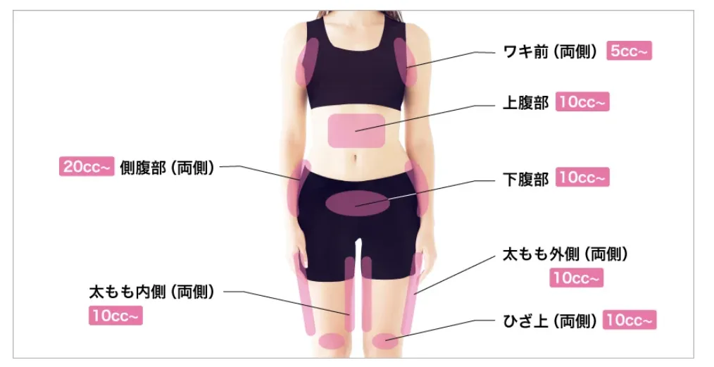 新潟で脂肪溶解注射のおすすめクリニック|部位別薬液使用量(体正面)