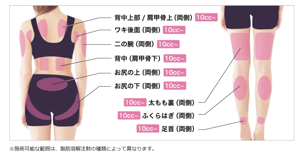 新潟で脂肪溶解注射のおすすめクリニック|部位別薬液使用量(背面)