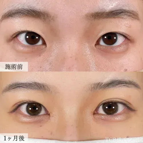 TCB大見貴秀医師が施術した症例写真画像