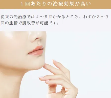 ルラ美容クリニックのルメッカは1回あたりの治療効果が高い。