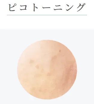 ルラ美容クリニック札幌院のピコトーニングに効果のある肌
