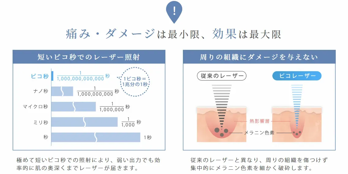 ルラ美容クリニック札幌院のピコレーザーの痛み・ダメージは最小限
