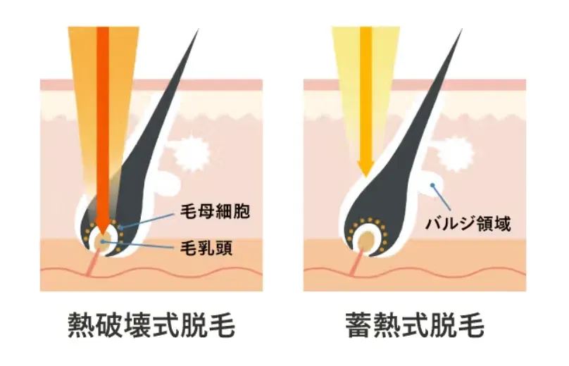 「熱破壊式」と「蓄熱式」の図解