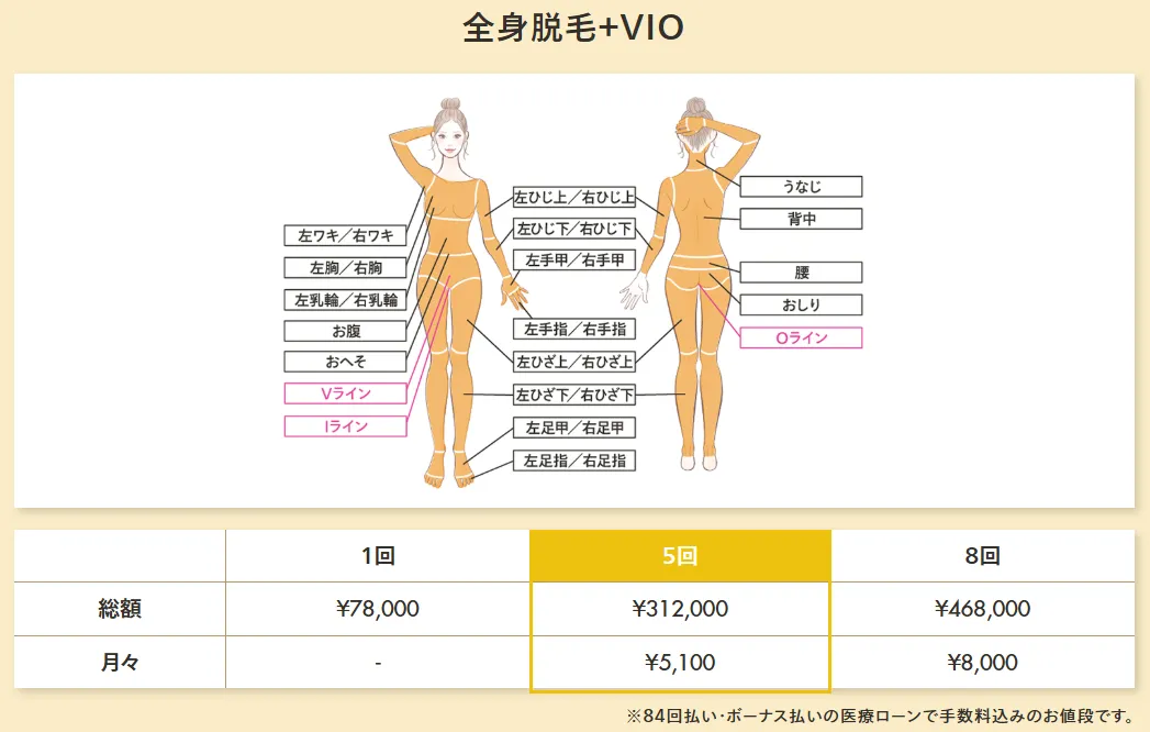 レジーナクリニックは都度払いできる?【知恵袋超え】リスクを抑えた契約方法も解説 都度払いの料金