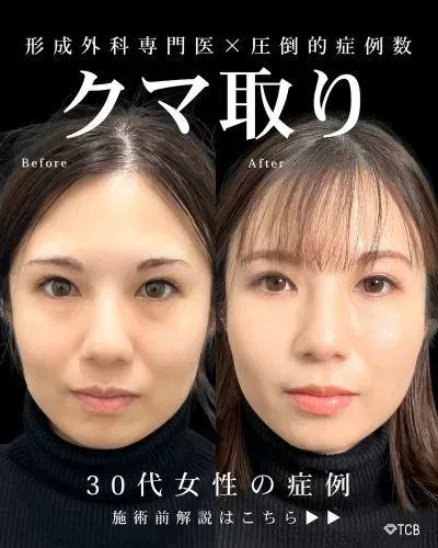 TCB佐野孝治医師による施術の症例写真