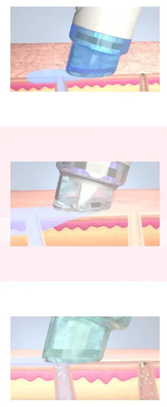 ハイドラフェイシャル機器2