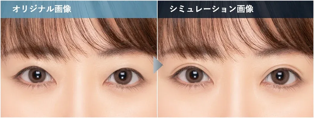 TCB品川院のカウンセリングで受けれるAIシミュレーター