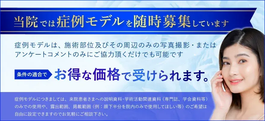 TCB品川院でモデル募集で施術をお得に受けられる