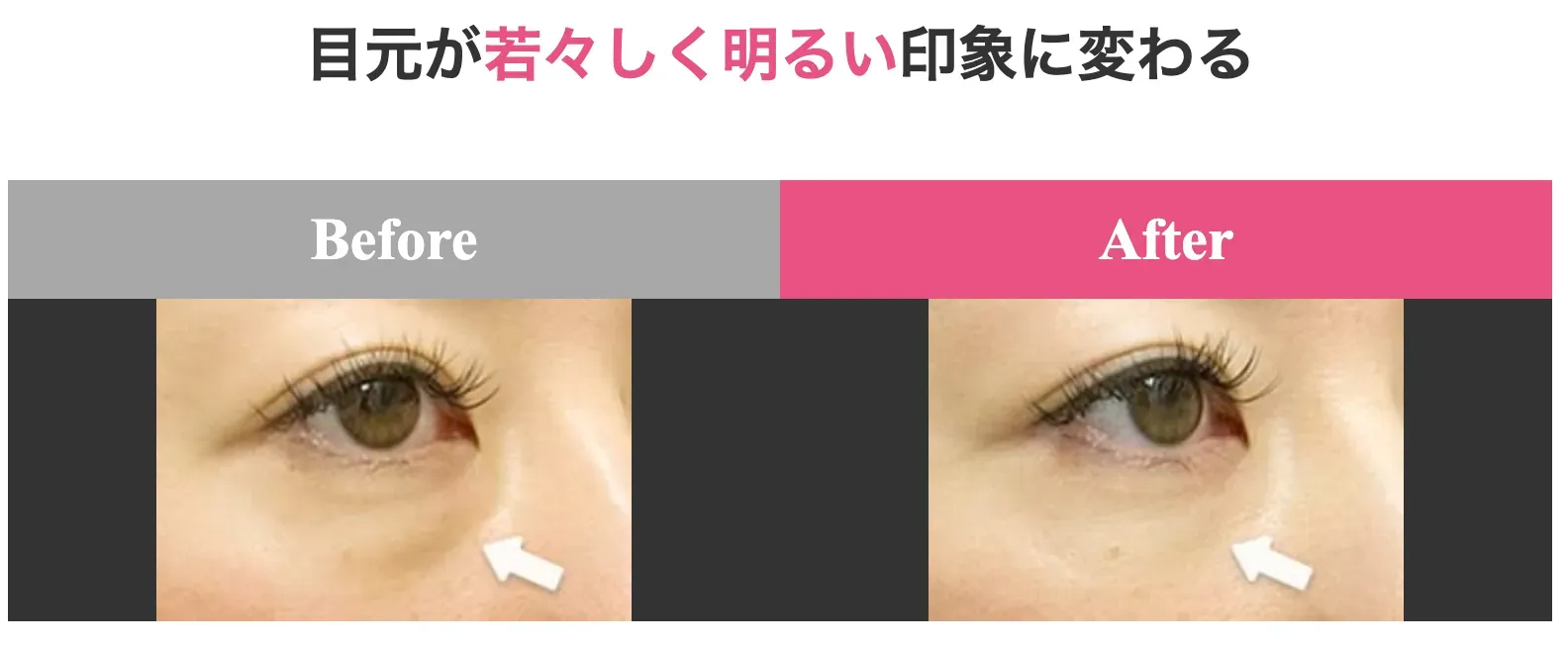 施術前後の写真
