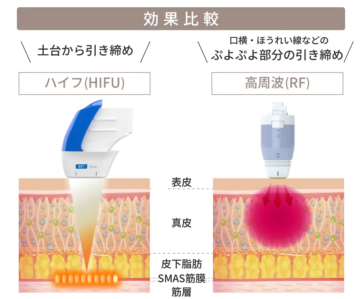 ハイフとボルニューマの比較