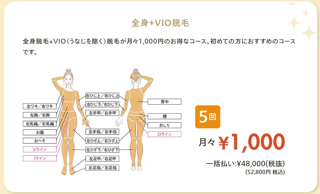 レジーナクリニック静岡院の全身+VIO脱毛の料金表