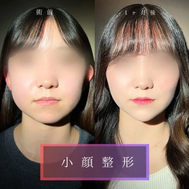 TCB新横浜院症例②