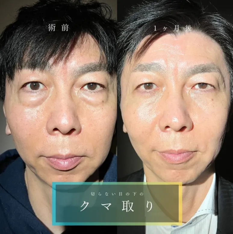 TCB新横浜院症例③