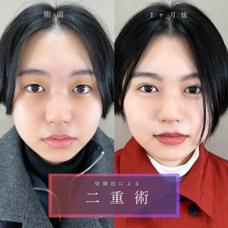 TCB新横浜院症例④