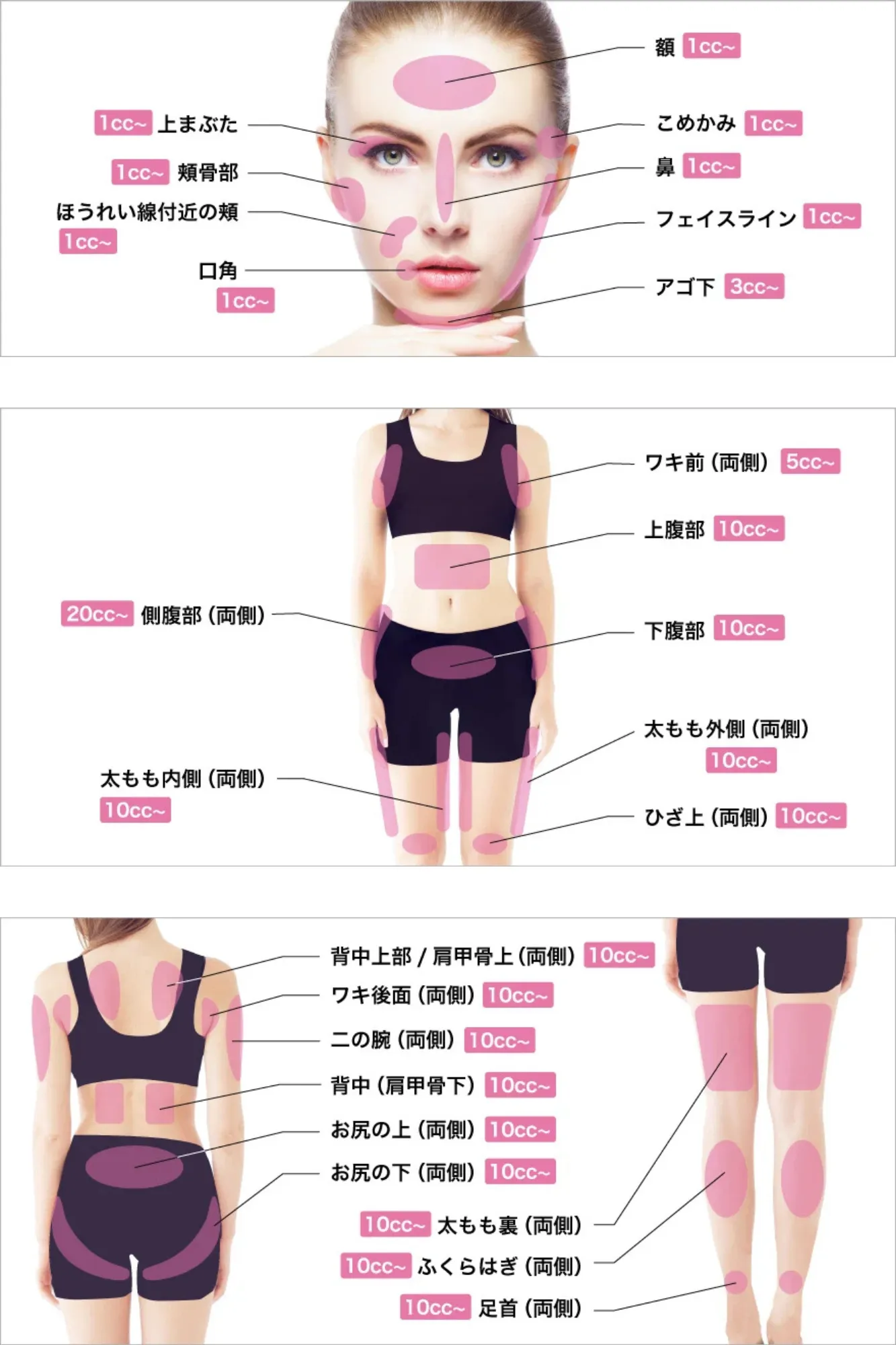 TCB　脂肪溶解注射の部位の画像