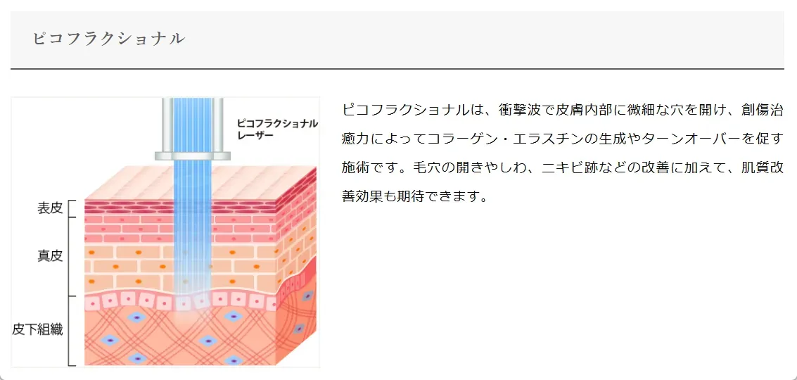 TCBのピコレーザーのピコフラクショナルの解説