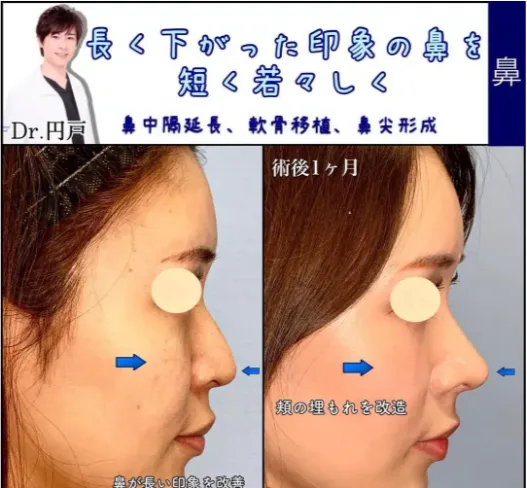 症例②