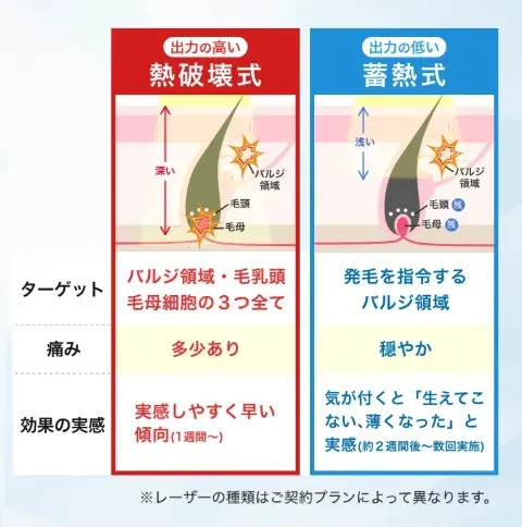 メンズエミナル　医療脱毛施術方法