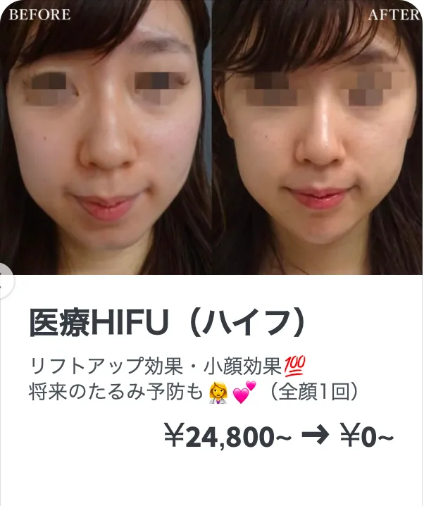 TCBの医療ハイフの症例