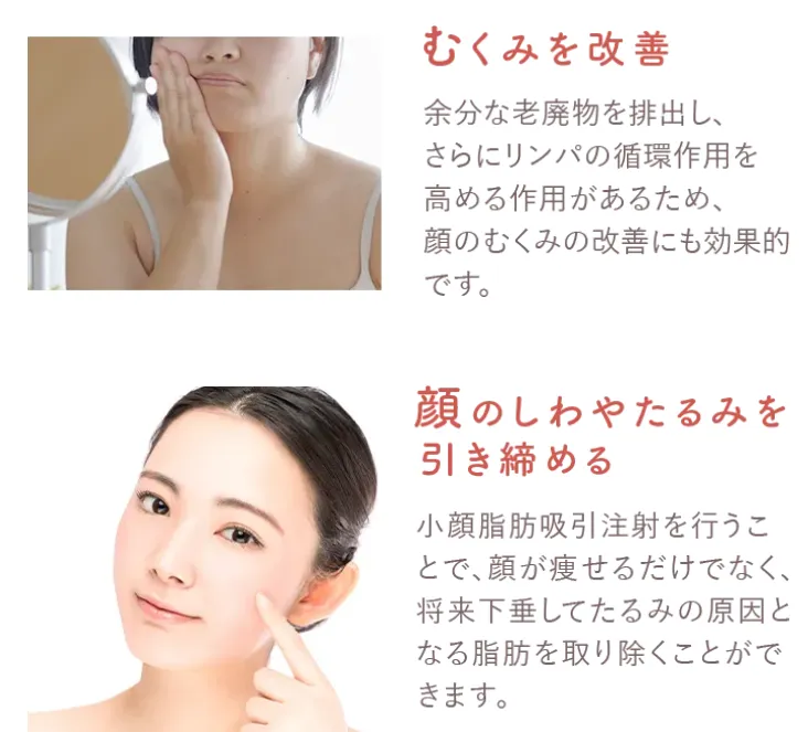 小顔脂肪吸引注射の効果