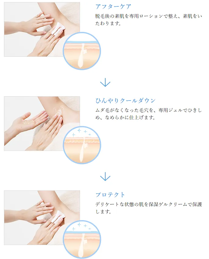 TBCのスーパー脱毛施術後のスキンケアの流れについて説明している画像