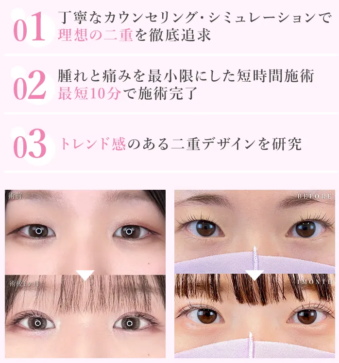 大田区で二重整形がおすすめのクリニック　TCBのLP画像