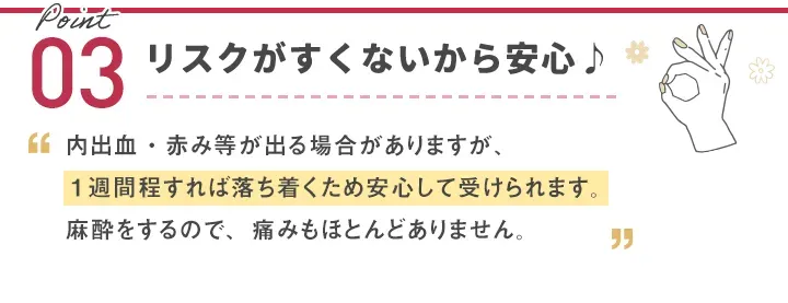 TCBのサブシジョンポイント3