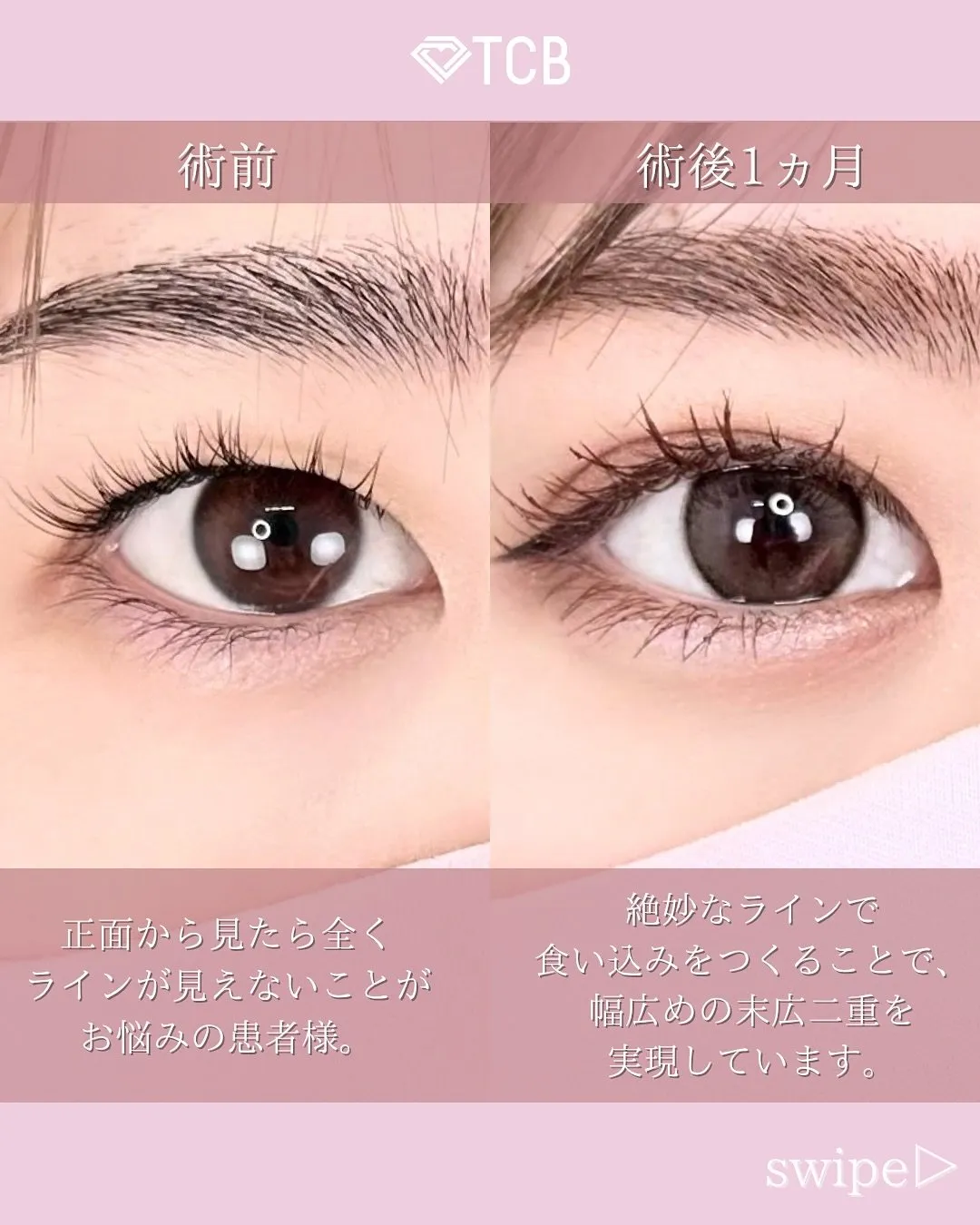 TCB栗林理佳医師の口コミ評判・経歴は？症例写真3