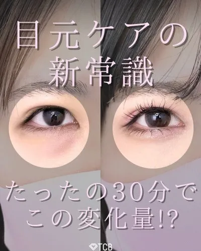 TCB栗林理佳医師の口コミ評判・経歴は？症例写真2