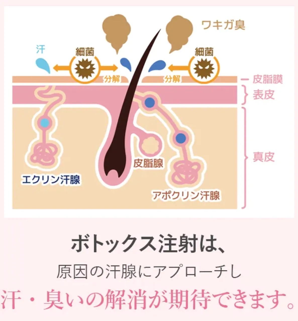 TCBの脇ボトックス注射の効果