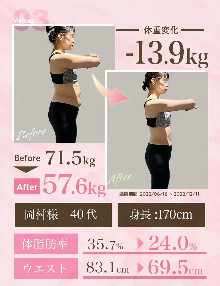 ディオクリニックの医療ダイエットで-13.9kg減量に成功