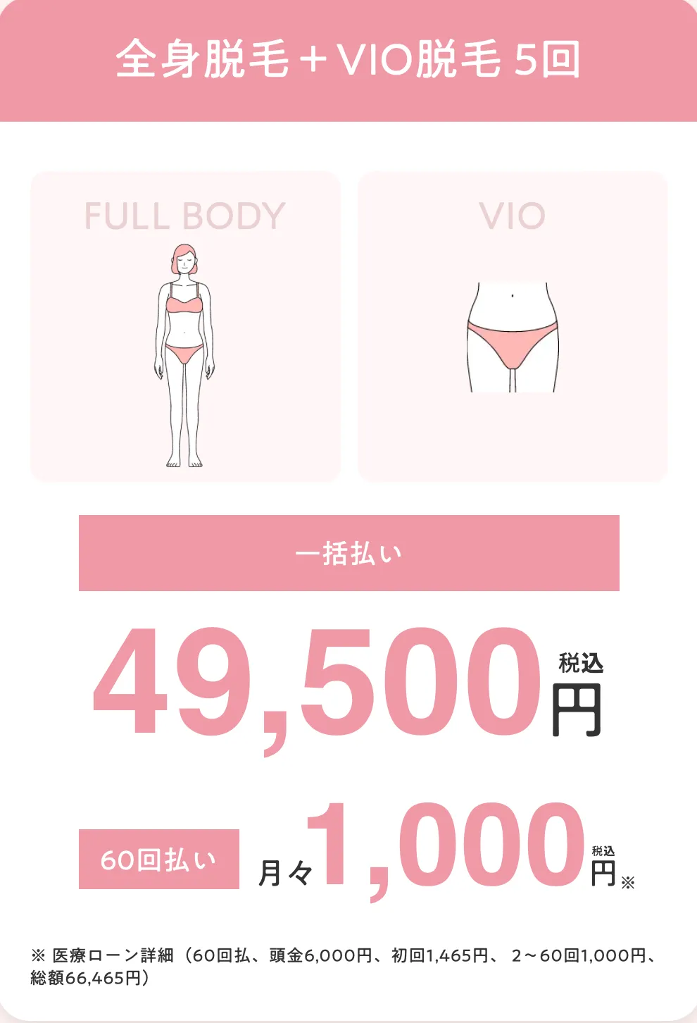 エミナルクリニックの全身脱毛+VIO脱毛5回プラン一括払いと60回払い