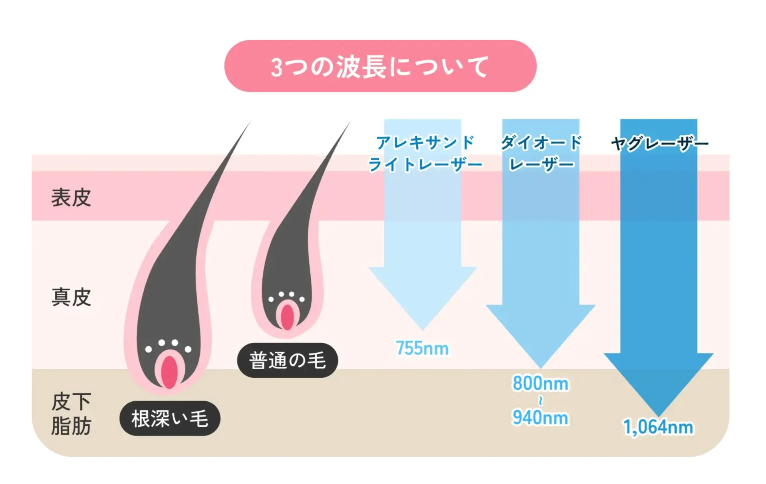 エミナルクリニック 3つの波長について