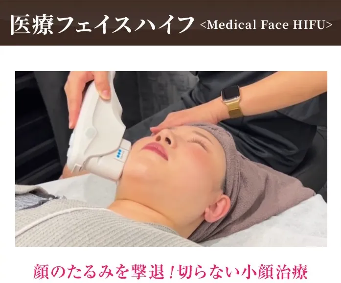 ディオクリニックの顔が痩せる方法4選のHIFU画像