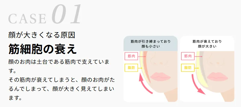 ディオクリニックの顔が痩せる方法における筋細胞の衰え画像