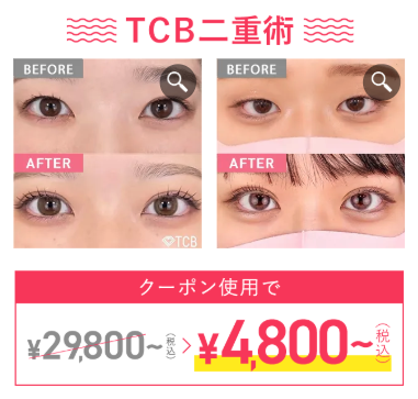 tcb二重術はクーポン利用で5,000円以下!