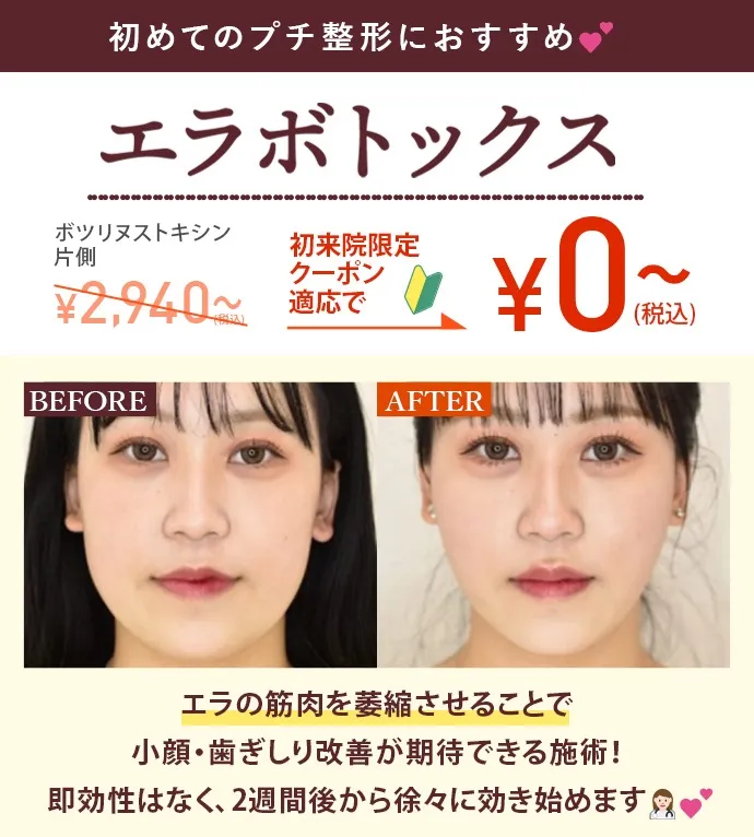 横浜でエラボトックスがおすすめのクリニック10選 初回クーポン