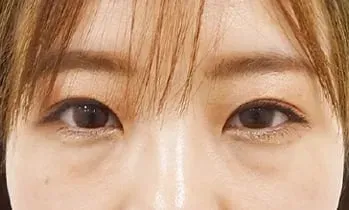 青クマ