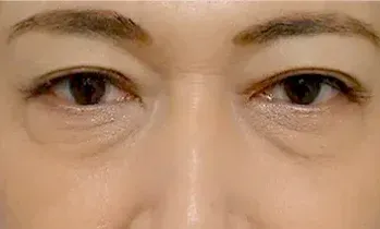 黒クマ