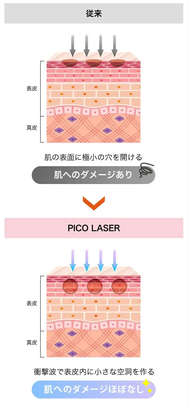ピコフラクショナル