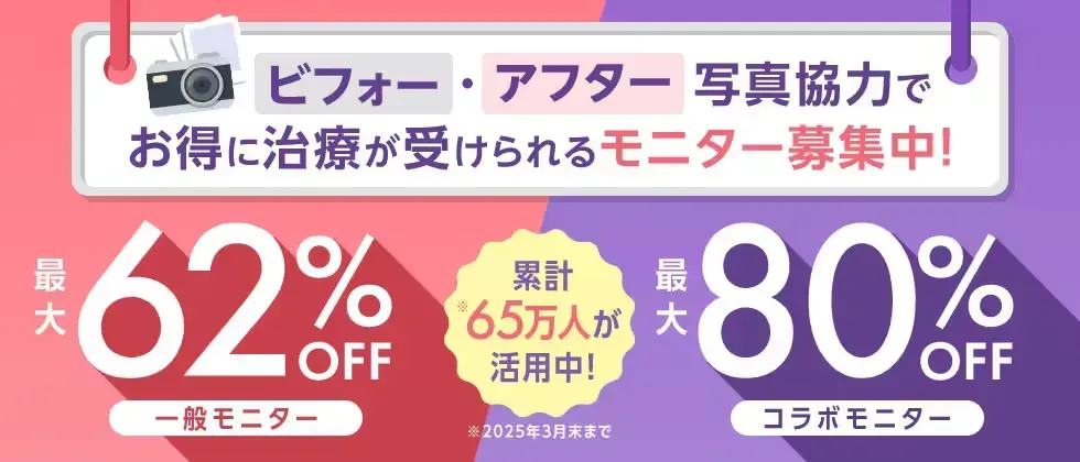 湘南美容クリニックのモニター利用で最大80%OFF