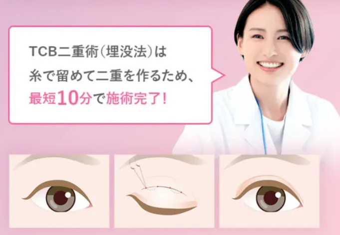 TCBの二重整形埋没法は最短10分で施術が完了する