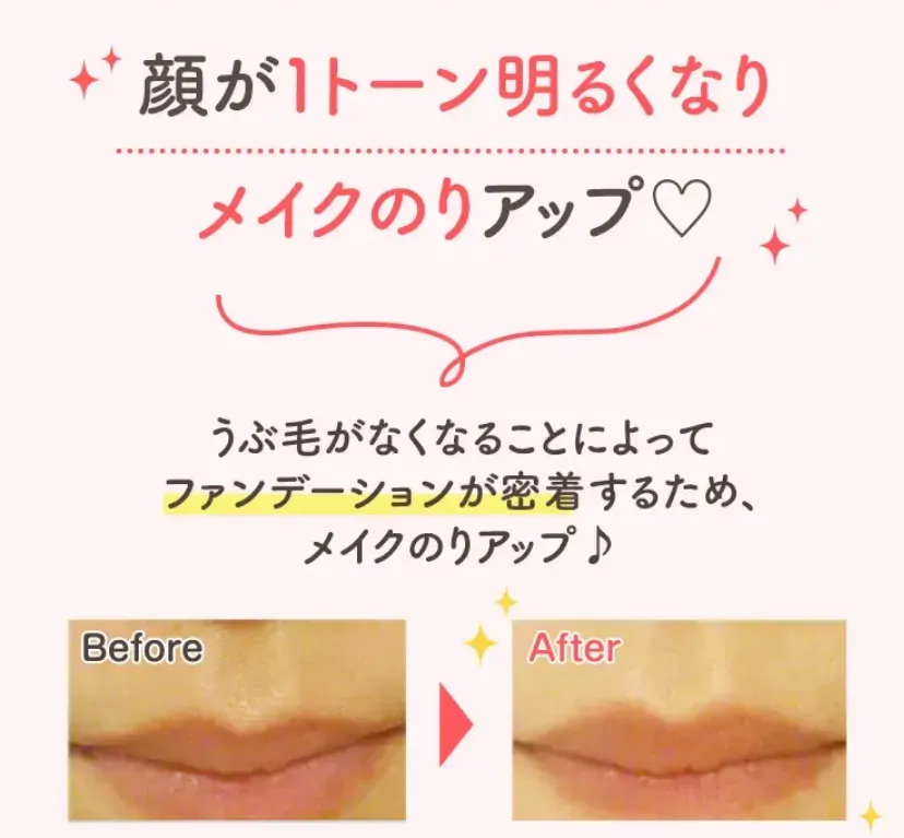 TBCの顔脱毛は、化粧ノリもUPさせる