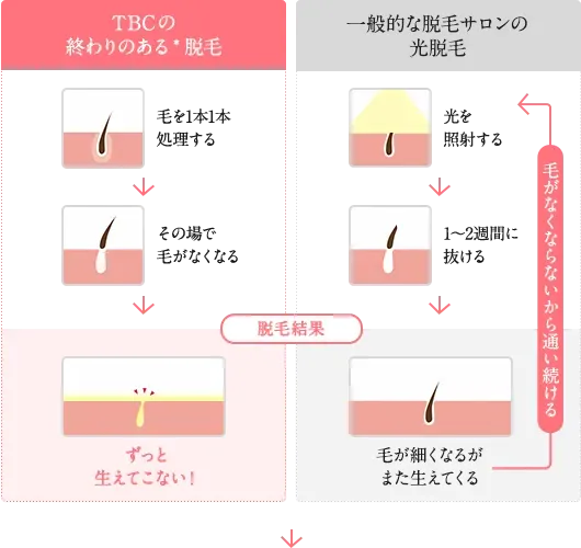 TBCの脱毛と一般的な脱毛サロンの光脱毛の比較表