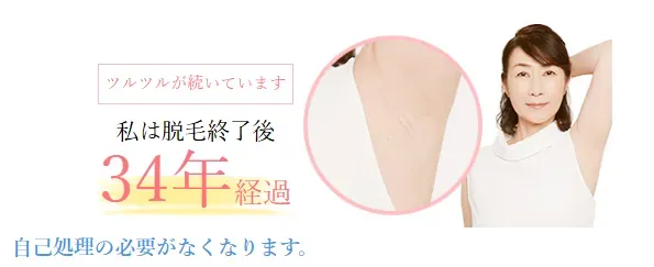 TBCの脱毛終了後34年経過後も自己処理の必要なしの画像