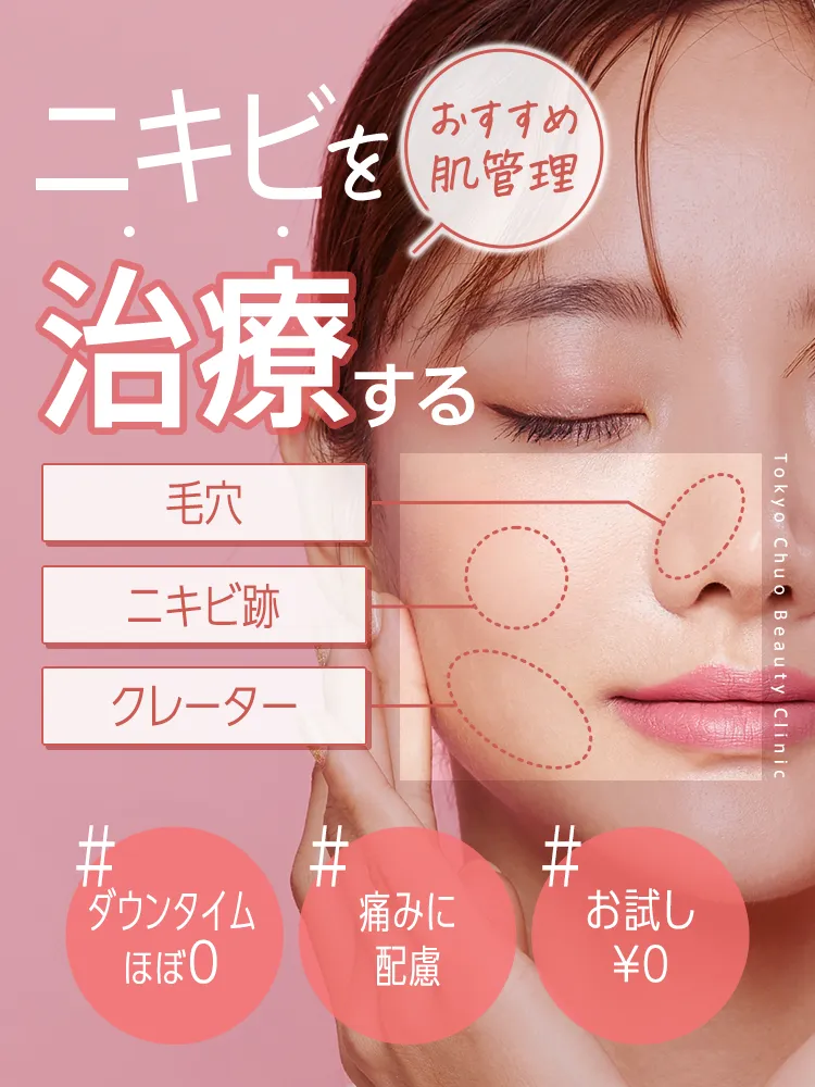 TCBのニキビ跡治療