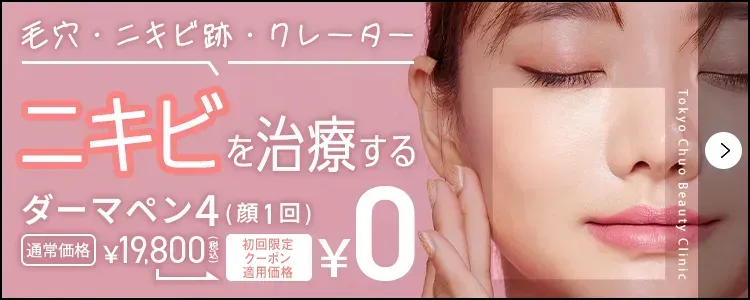 TCBのニキビ跡治療が無料