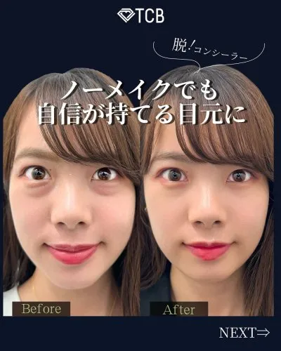 村田医師の症例