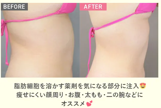 TCBで施術溶解注射をうけた方の症例写真