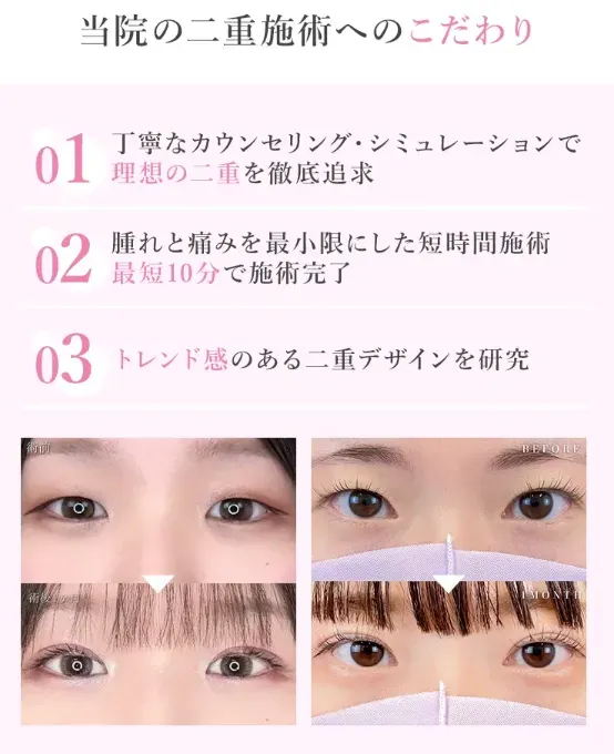 TCBの二重整形へのこだわりについて